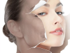 ĐIỀU TRỊ SẮC TỐ NÁM 