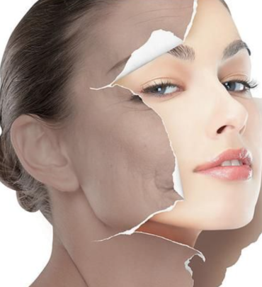 ĐIỀU TRỊ SẮC TỐ NÁM 